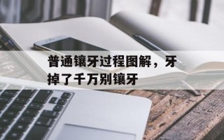 普通镶牙过程图解，牙掉了千万别镶牙