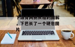 下颌骨两侧长痘的图解，下巴长了一个硬包图片