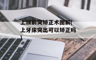 上颌前突矫正术图解(上牙床突出可以矫正吗)