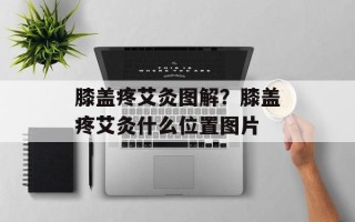 膝盖疼艾灸图解？膝盖疼艾灸什么位置图片