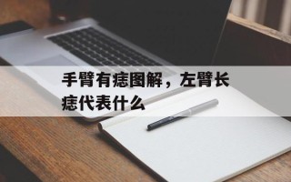 手臂有痣图解，左臂长痣代表什么