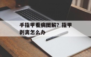 手指甲看病图解？指甲剥离怎么办