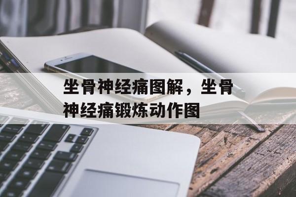 坐骨神经痛图解，坐骨神经痛锻炼动作图-第1张图片-