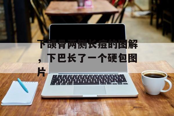 下颌骨两侧长痘的图解，下巴长了一个硬包图片-第1张图片-